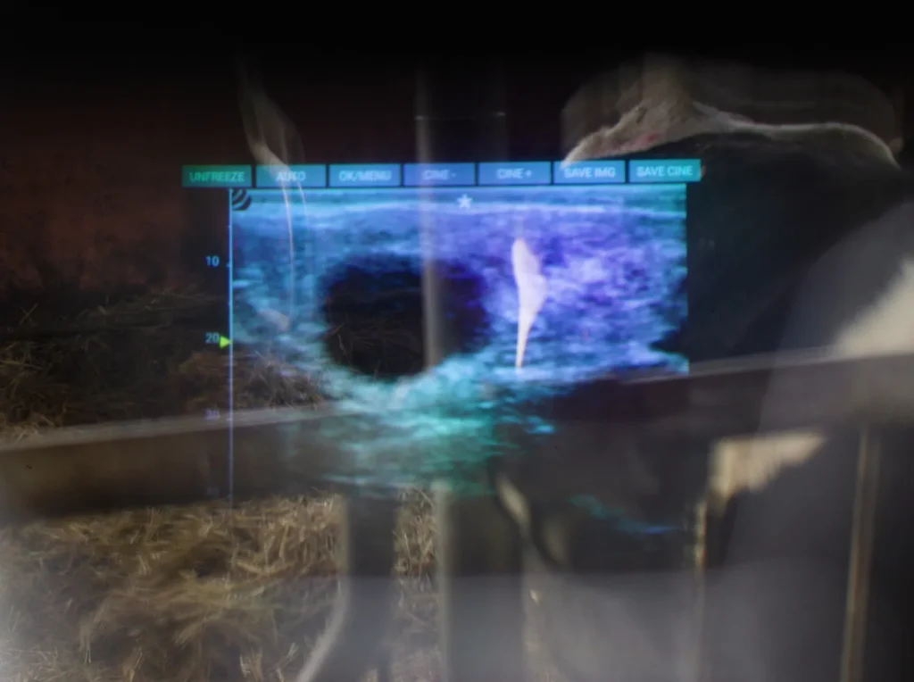 iLens Dramiński – transmission fluide des images échographiques sans fil