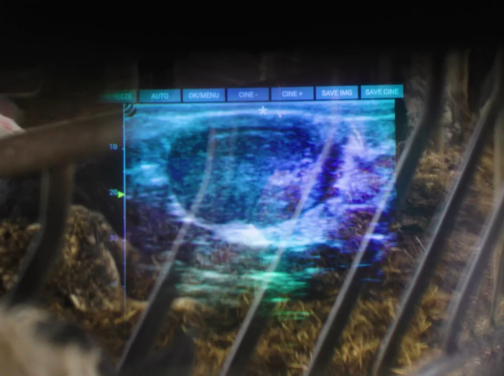 iLens Dramiński – transmission fluide sans fil des images d’ultrasons